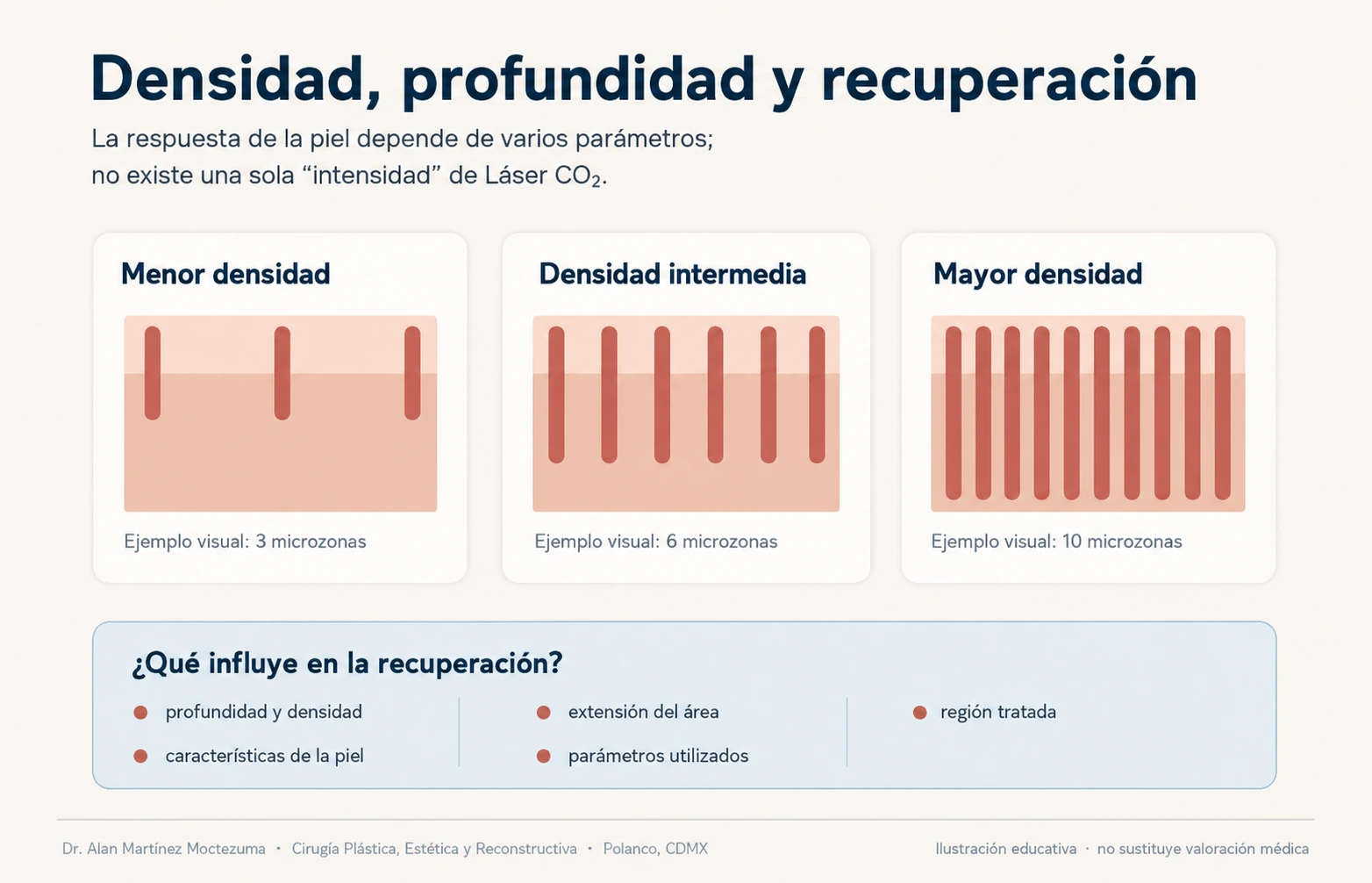 Diagrama editorial que compara diferentes densidades y profundidades de microzonas en Láser CO₂ fraccionado