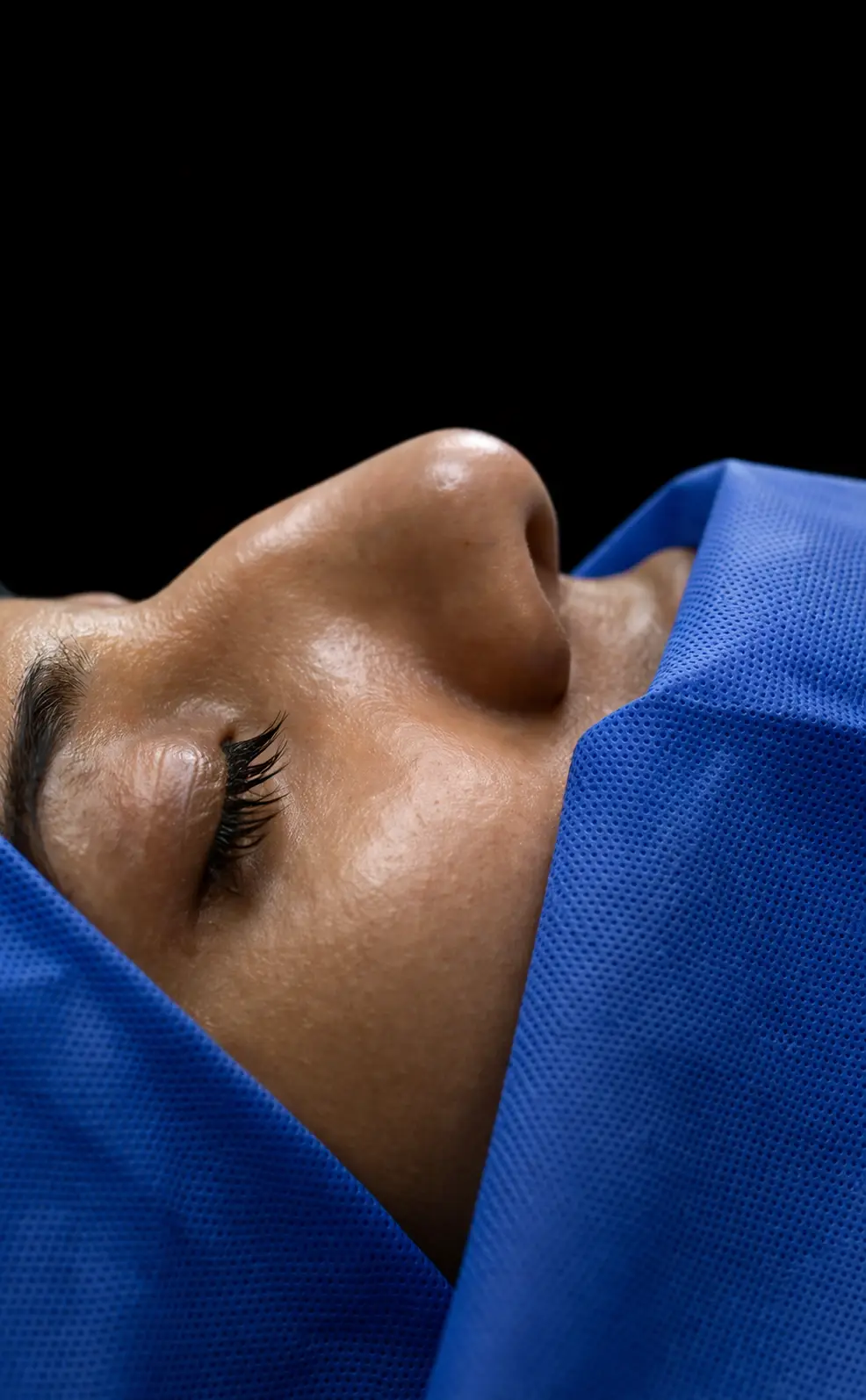 Documentación clínica: morfología nasal previa a rinoplastia — Dr. Alan Martínez Moctezuma, Polanco CDMX