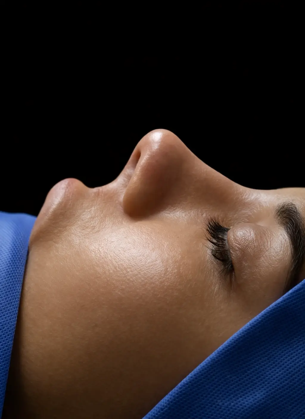 Documentación clínica: evolución postquirúrgica de rinoplastia — misma paciente — Dr. Alan Martínez Moctezuma, CDMX